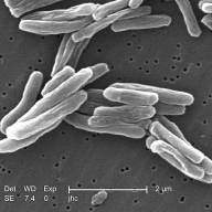 NRL of Tuberculosis 