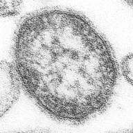 NRL of Measles, Mumps and Rubella